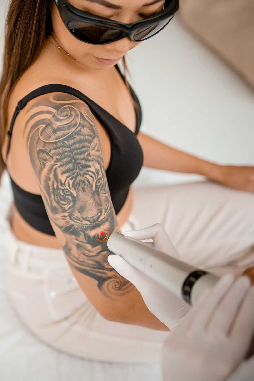 A skin therapist treating a black and grey tiger sleeve tattoo with the LightSense laser