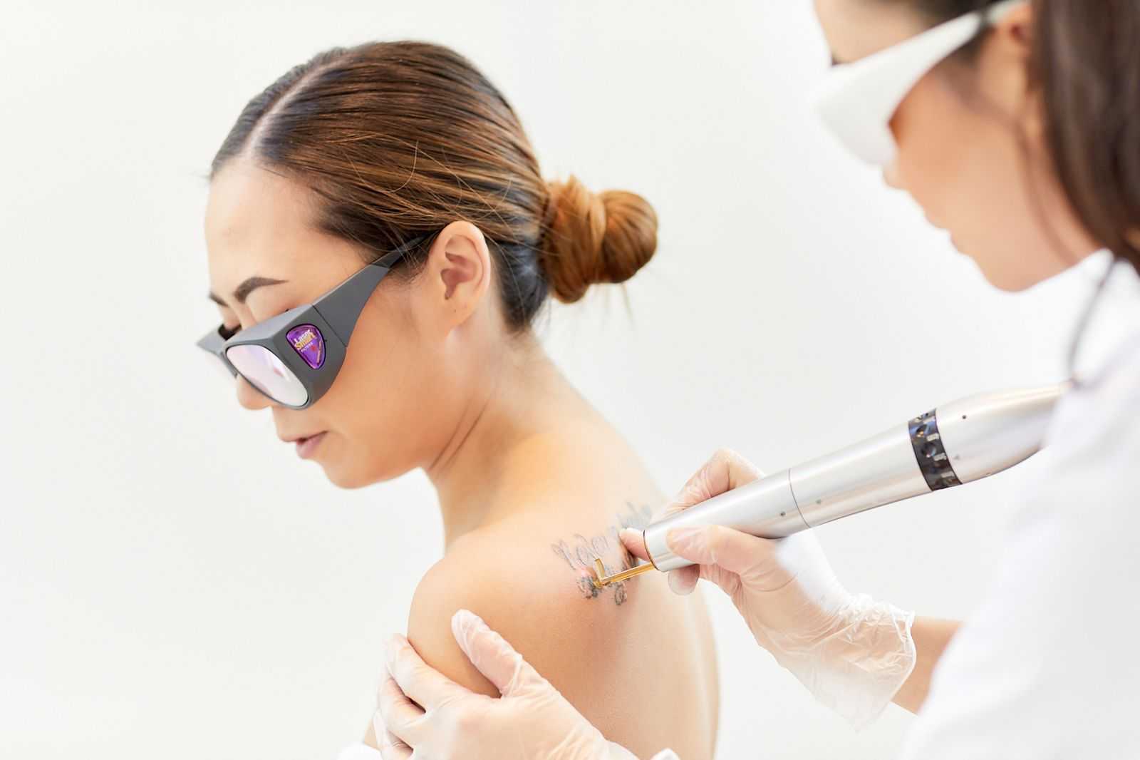 A NAAMA practitioner treating a tattoo on a client's shoulder